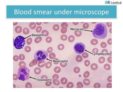 PPT - DIFFERENTIAL LEUCOCYTE COUNT (DLC) PowerPoint Presentation - ID ...