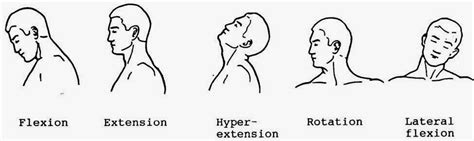 Arc4life's Natural Pain Relief Blog for the Neck and Low Back: A look ...