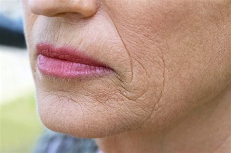 The 5 Types of Skin Aging and How to Identify Them