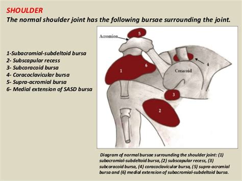 MRI Musculo-Skeletal Section: Bursa of shoulder.