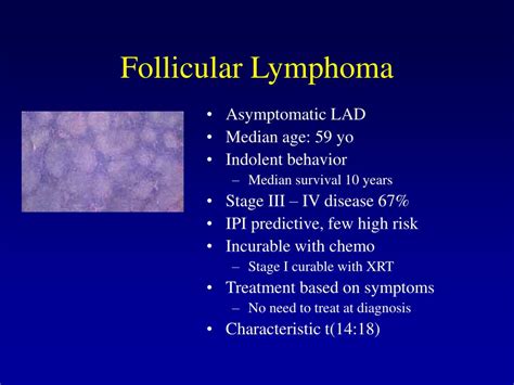 Follicular Lymphoma Symptoms