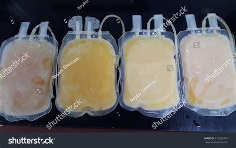 Fresh Frozen Plasma Stock Photo 510580774 : Shutterstock