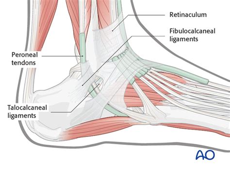 Sinus tarsi approach to the calcaneus