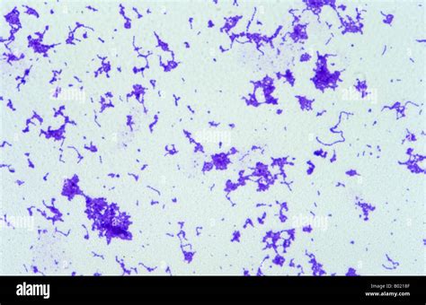 Streptococcus Pyogenes Gram Staining