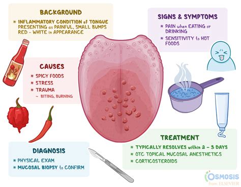 Bumps On The Tongue Causes Picture Symptoms And Treatment – NBKomputer