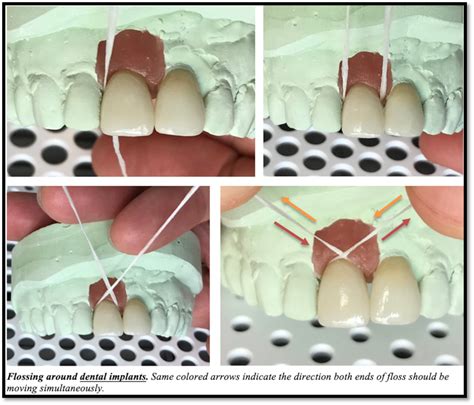 Is flossing really that important? > Wright-Patterson AFB > Article Display