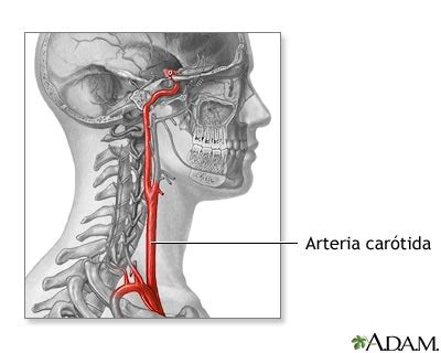 Anatomía de la arteria carótida: MedlinePlus enciclopedia médica ...