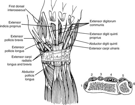 Extensor Tendon Injury | Musculoskeletal Key