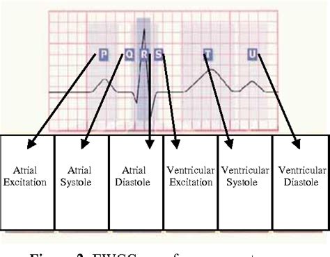 Figure 1 from Atrial Excitation Atrial Systole Atrial Diastole ...