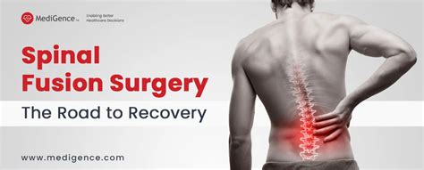 Spinal Fusion Surgery Recovery: What to expect?