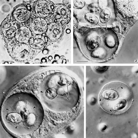 Schematic drawing of the sporocyst wall (sW) consisting of an inner ...