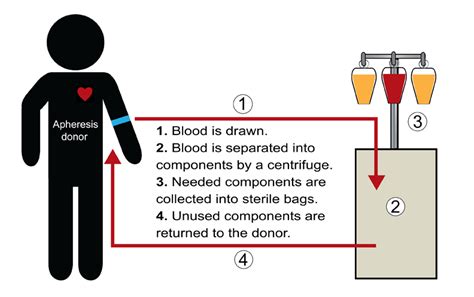 Platelet Apheresis - A Complete Guide | Sankalp India Foundation