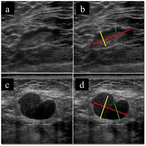 Medicina | Free Full-Text | Clinical Usefulness of Ultrasound-Guided ...