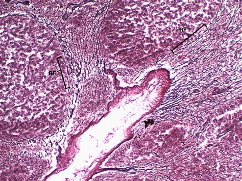 Reticular Fiber Histology