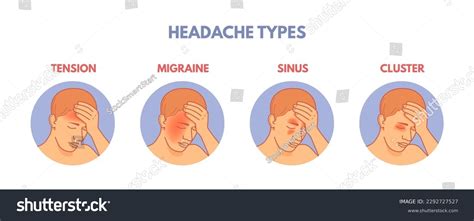 Headache Types Headaches Areas Infographic Diagram Stock Vector ...