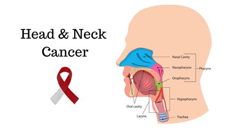 Head and Neck Cancer- Signs and Symptoms - Yashoda Hospital