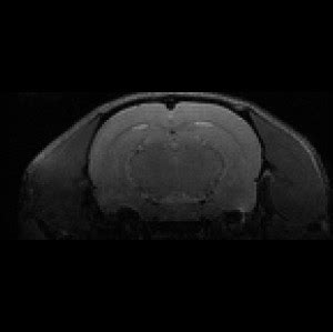 Rat Brain Anatomical MRI - Biomedical Research Imaging Center