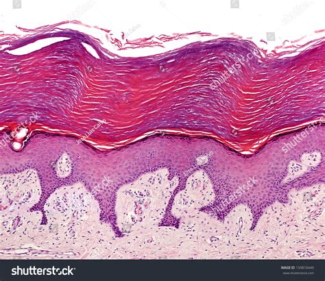 Photo de stock Epithélium squameux kératifié stratifié de la 159810449 ...