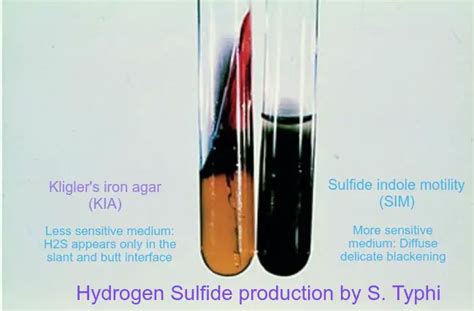 Hydrogen Sulfide (H2S) Production Test Virtual Microbiology, 56% OFF