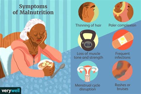 Malnutrition – Causes and Symptoms - Wapking Zone