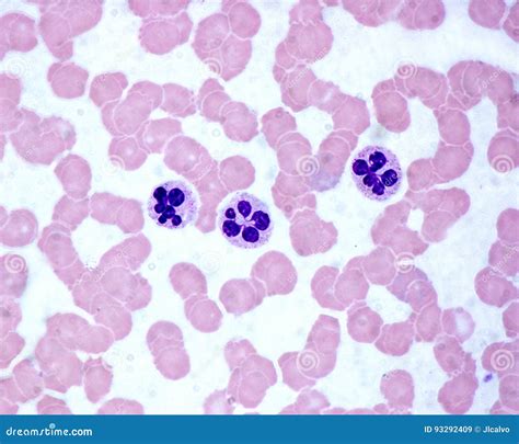 Neutrophils. Blood smear stock image. Image of microscopic - 93292409