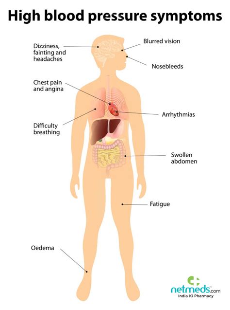 Hypertension: Am I At Risk?