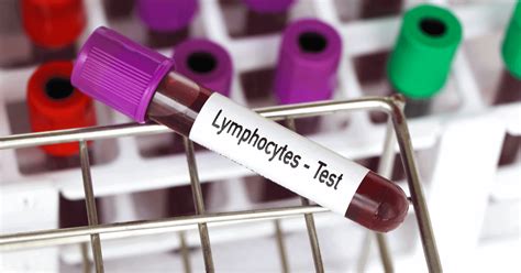 Lymphocytosis (High Lymphocyte Count): Symptoms, Causes & Diagnosis