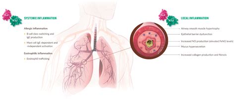 DUPIXENT® (dupilumab) Mechanism of Action