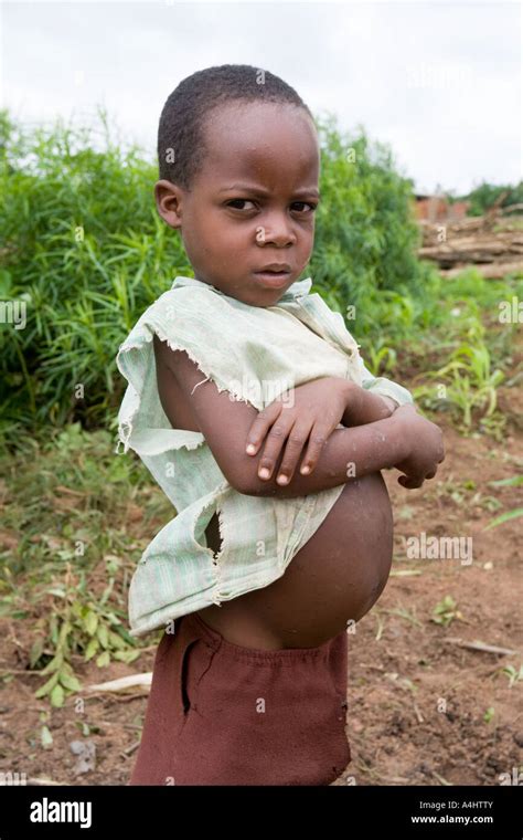 Starving African Children Smiling