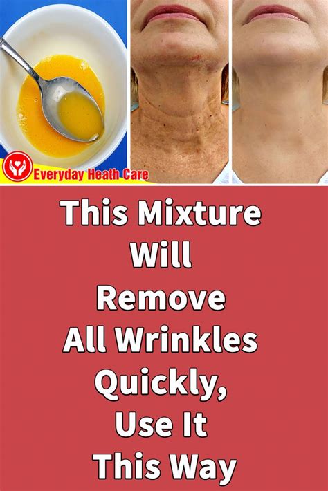 This Mixture Will Remove All Wrinkles Quickly, Use It This Way in 2020 ...