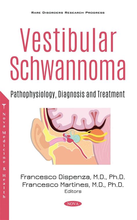 Vestibular Schwannoma: Pathophysiology, Diagnosis and Treatment – Nova ...