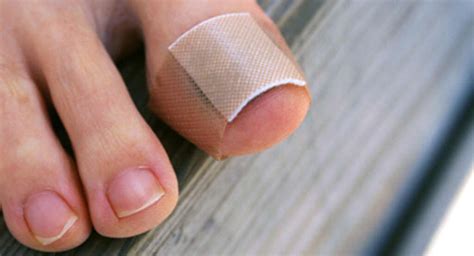 Hammer Toe: 10 Causes of Hammer Toe