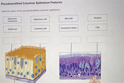 Solved Pseudostratified Columnar Epithelium Features Label | Chegg.com