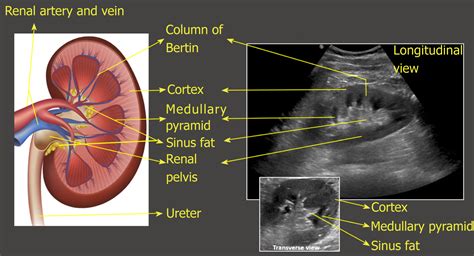 Kidney Ultrasound Labeled