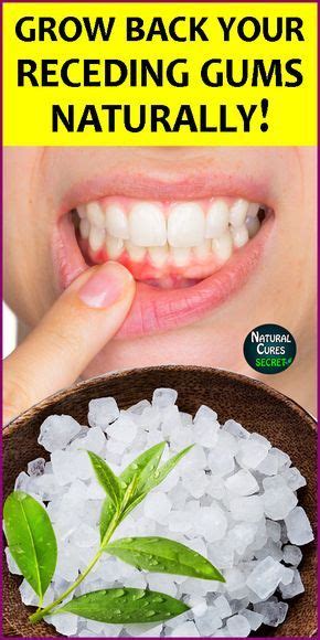 Home Remedies For Gum Disease - Healthy Lifestyle