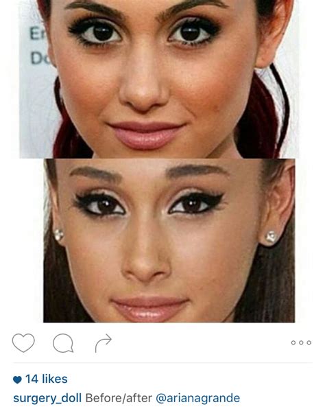 Ariana Grande | Rhinoplasty nose jobs, Ariana grande nose job, Nose ...