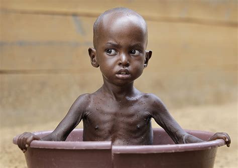 REPORT: More Africans Suffering from Hunger, Malnutrition | ChimpReports