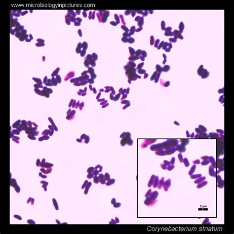 Corynebacterium striatum microscopy. Diphtheroids micrograph ...