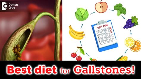 Food and drinks to eat and avoid if you have Gallstones - Dr. Nanda ...