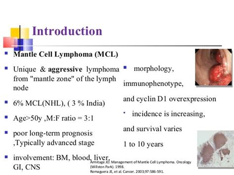 Micro rna signature with indolent non hodgkin lymphomas