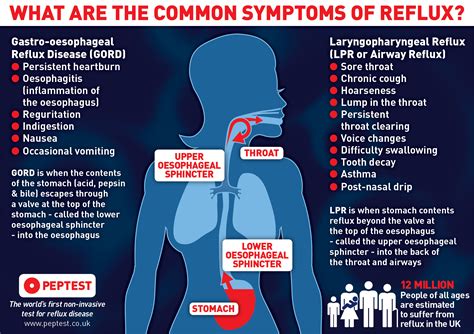 What Is Gerd Treatment