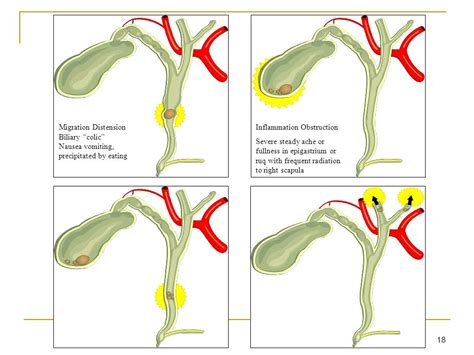 What are Symptoms of Biliary Colic | Health Life Media