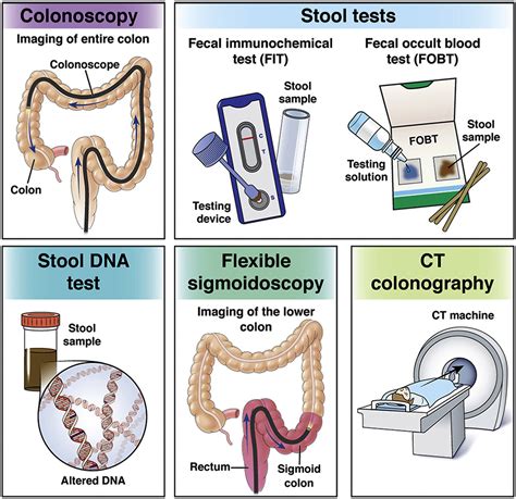 Colorectal Cancer Screening Options - Clinical Gastroenterology and ...