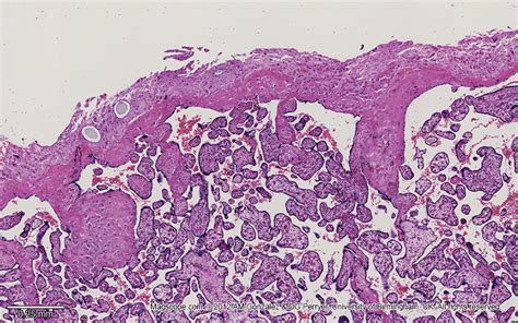 A Histology Of Normal Healthy Placenta Download