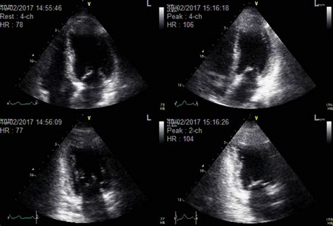 Understanding Echocardiograms | cardiacsolutions