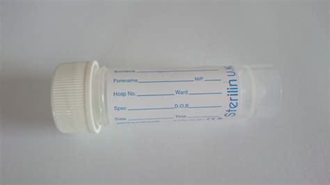 Osmolality (Serum and Urine) / Blood Sciences Test / Exeter Clinical ...