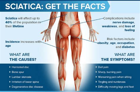 Sciatica: “Why Does My Back Problem Cause Such Severe Leg Pain?"