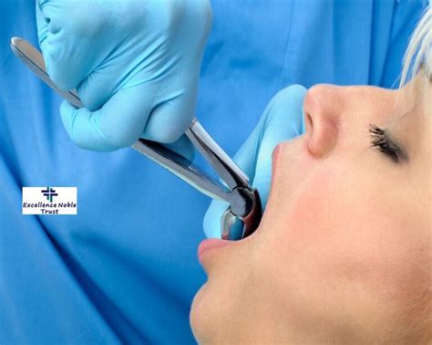 Best Oral Surgeries In Delhi - ORL International Hospital