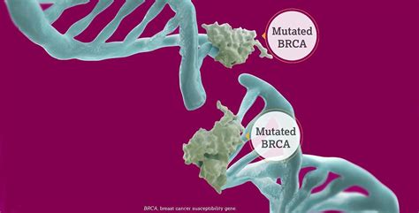 Breast Cancer | Precision Medicine