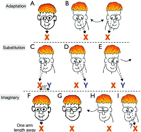 Exercises for promoting gaze stability. Adaption: (A) to test the ...